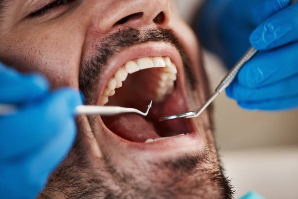 Best Cracked Tooth Emergency Dentist  in Rotonda, FL