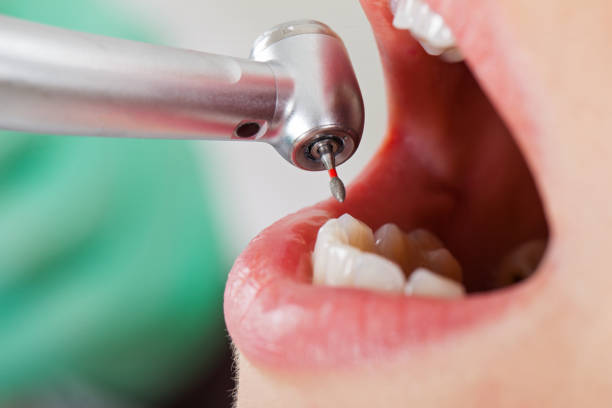 Best Urgent Tooth Repair  in Rotonda, FL